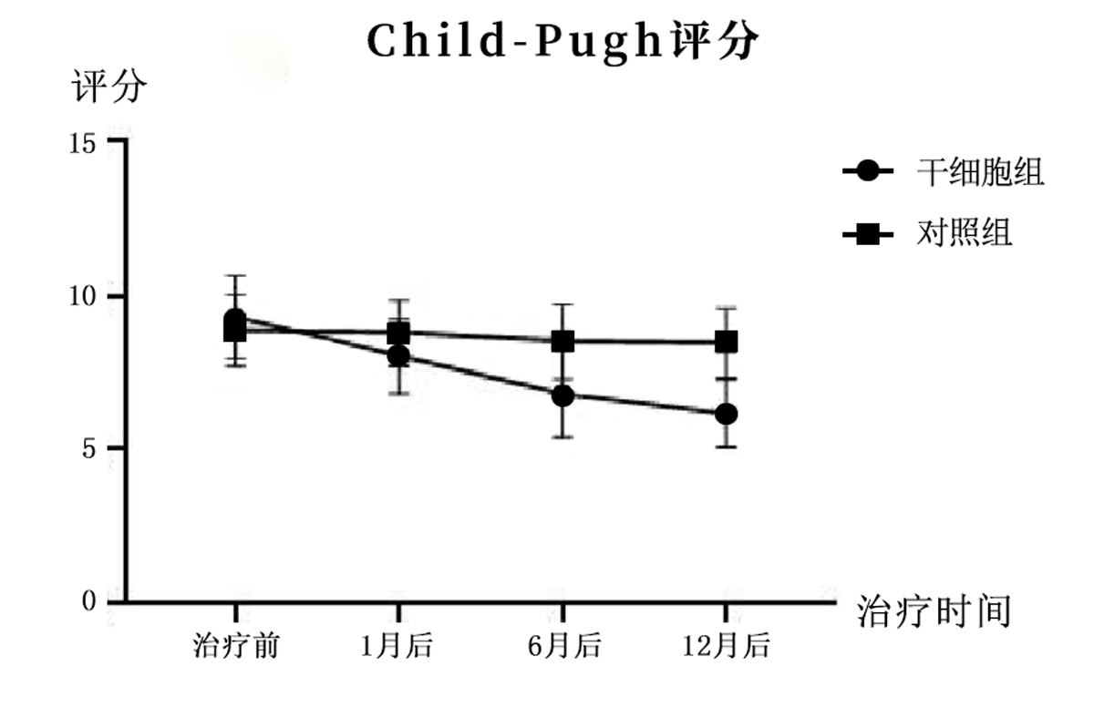 干细胞治疗肝硬化